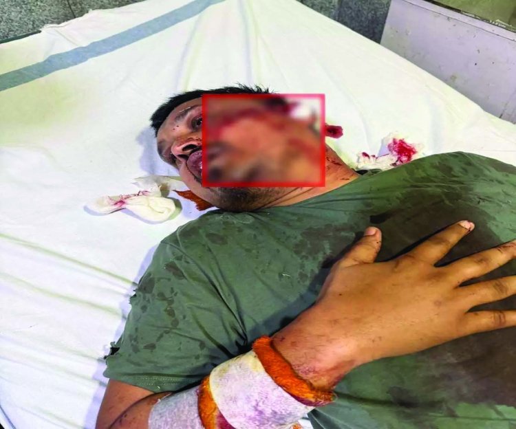 रायपुर केंद्रीय जेल में गैंगवार :युवा कांग्रेस के नेता पर जानलेवा हमला, मेकहारा में भर्ती