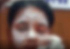 “कॉलेज जाने निकली युवती पर अज्ञात युवक ने फेंका एसिड, हमले के बाद तांदुला बांध के जंगल की ओर भागा”